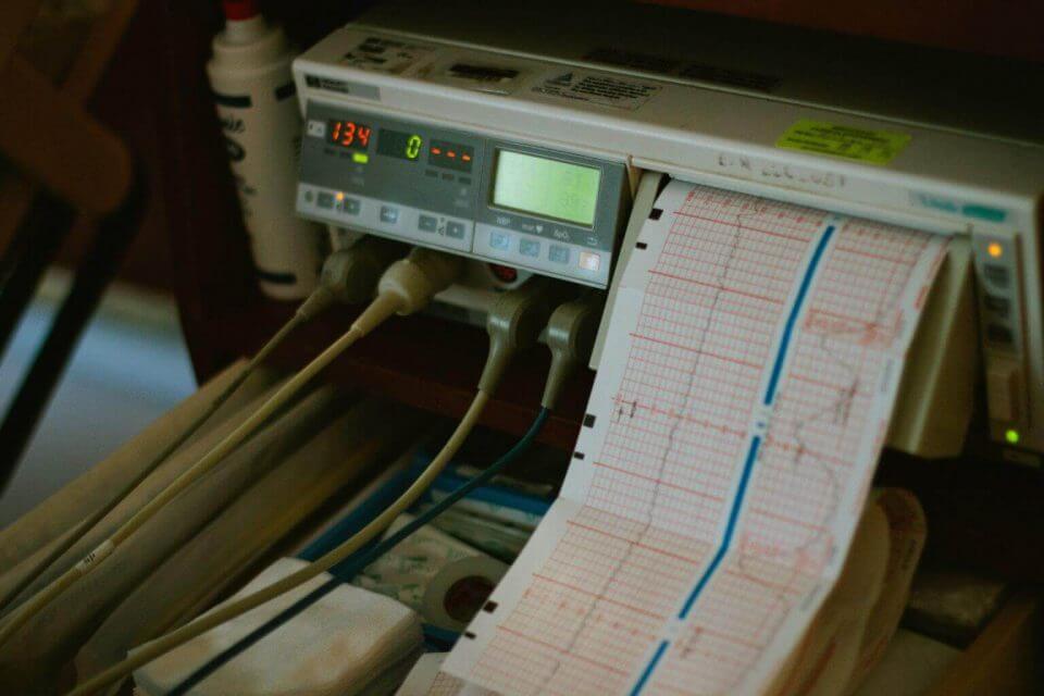 ECG reading coming out of a machine